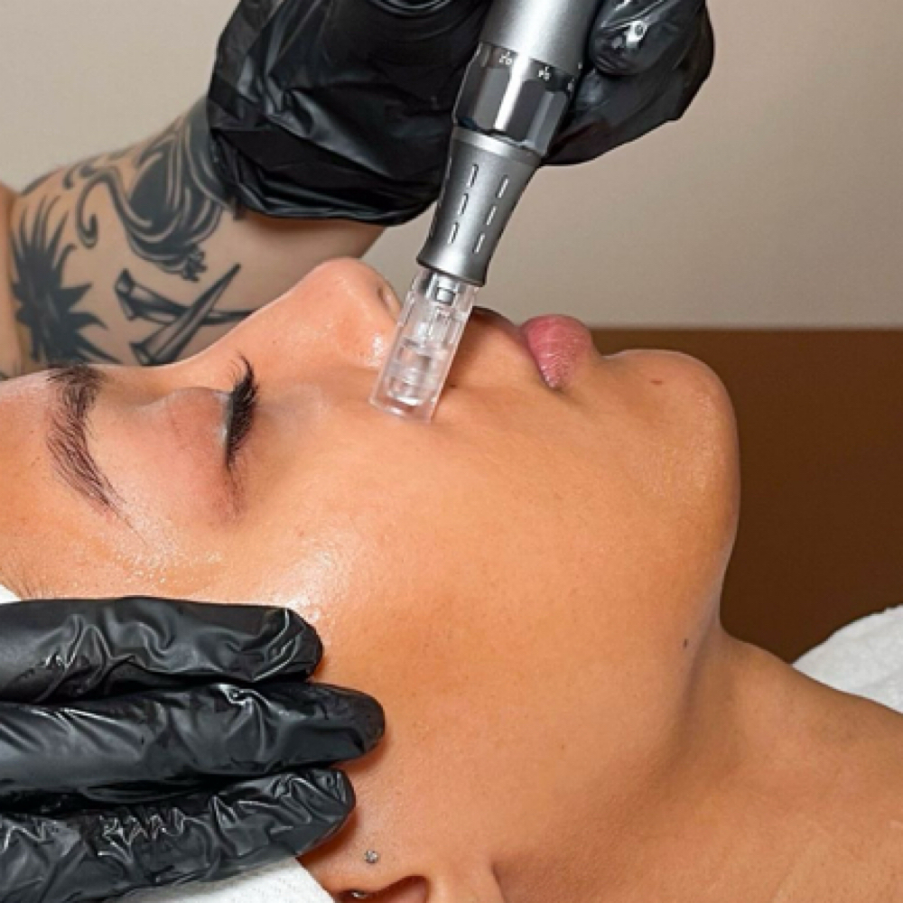 Microneedling at Skintuition Skincare Boutique in Pewee Valley, KY