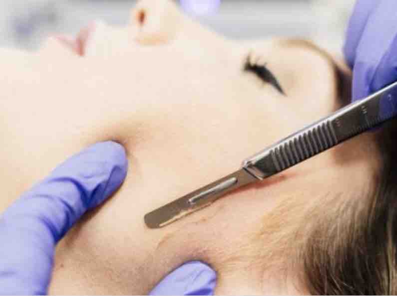 Express Dermaplane