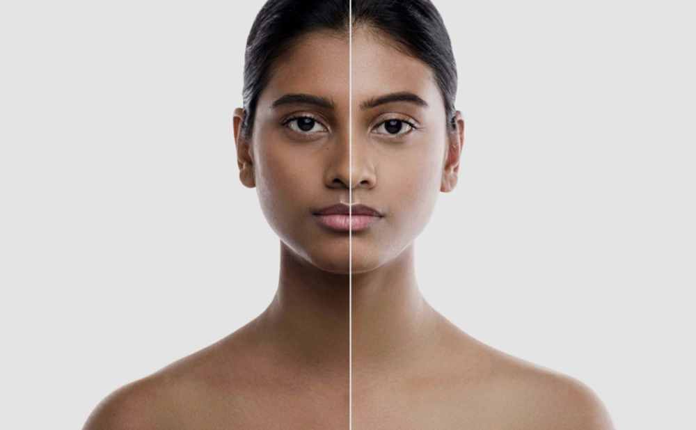 Skin Brightening Treatment