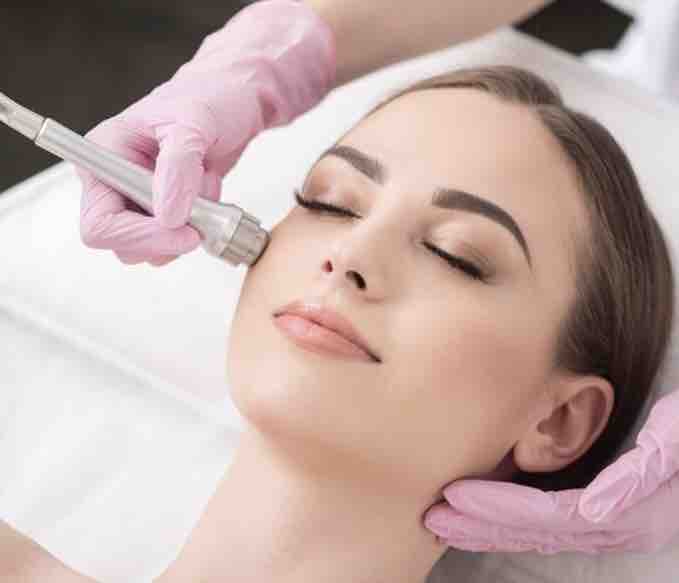 Microdermabrasion Facial