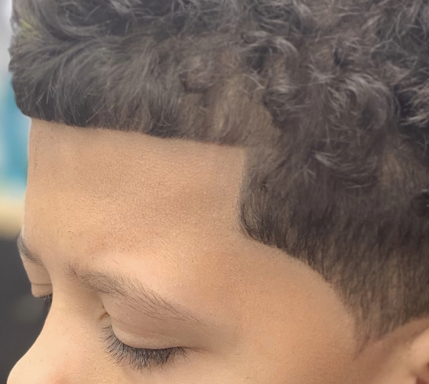 KIDS: Hairline