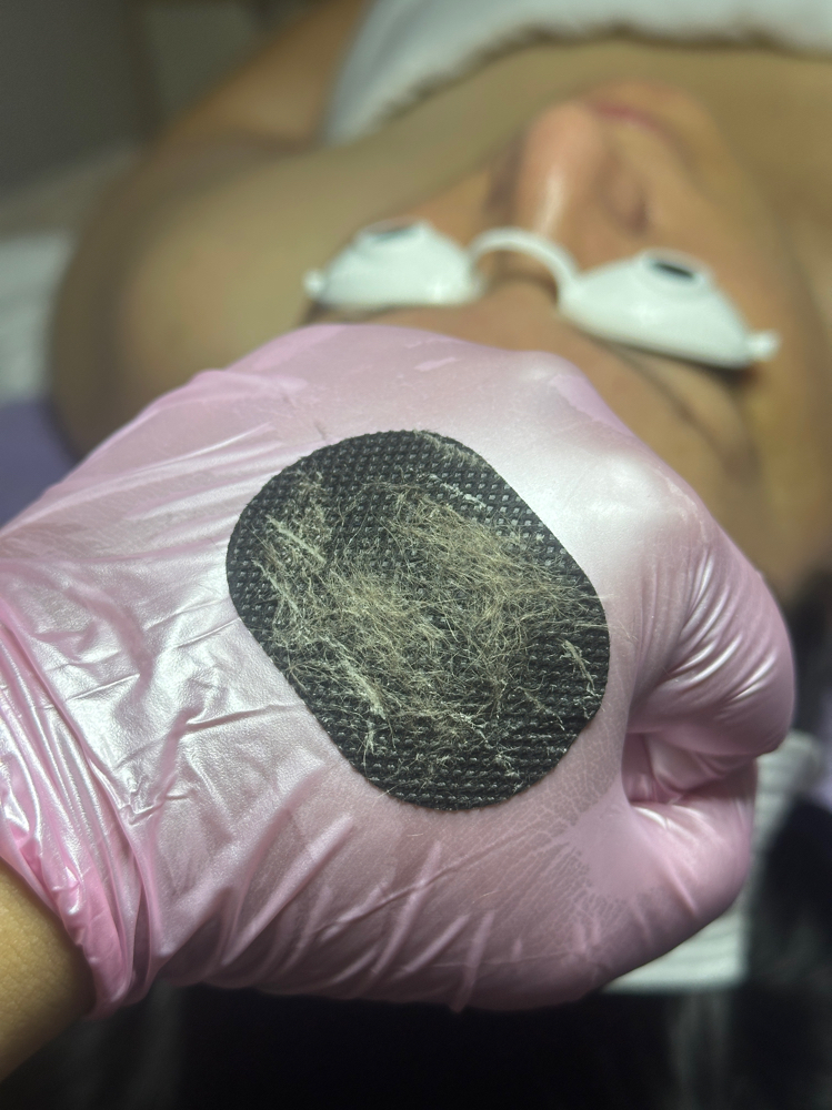 Dermaplaning Add On