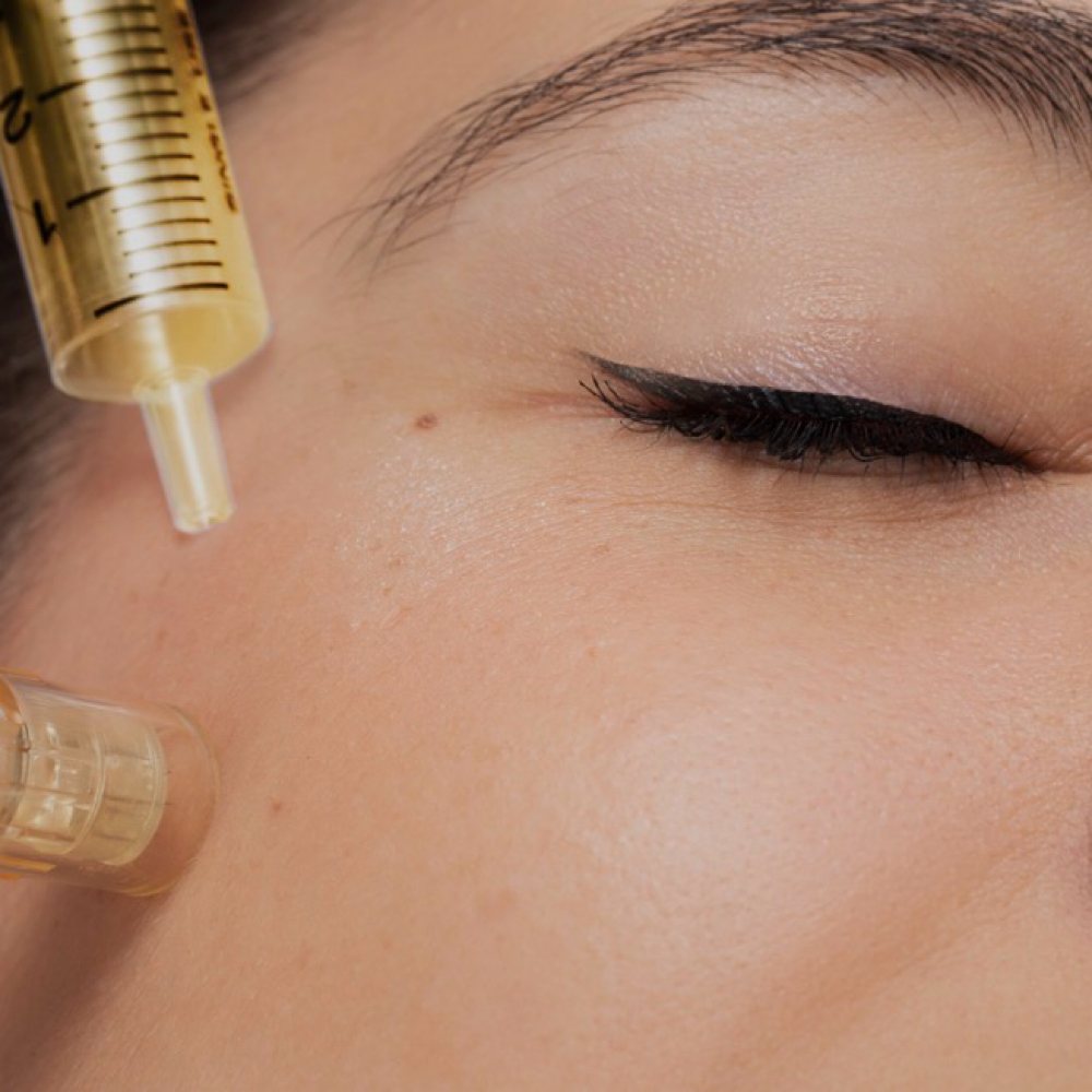 Liquid Gold PRP Facial at Spatium Urgent Care & Wellness in Marietta, GA