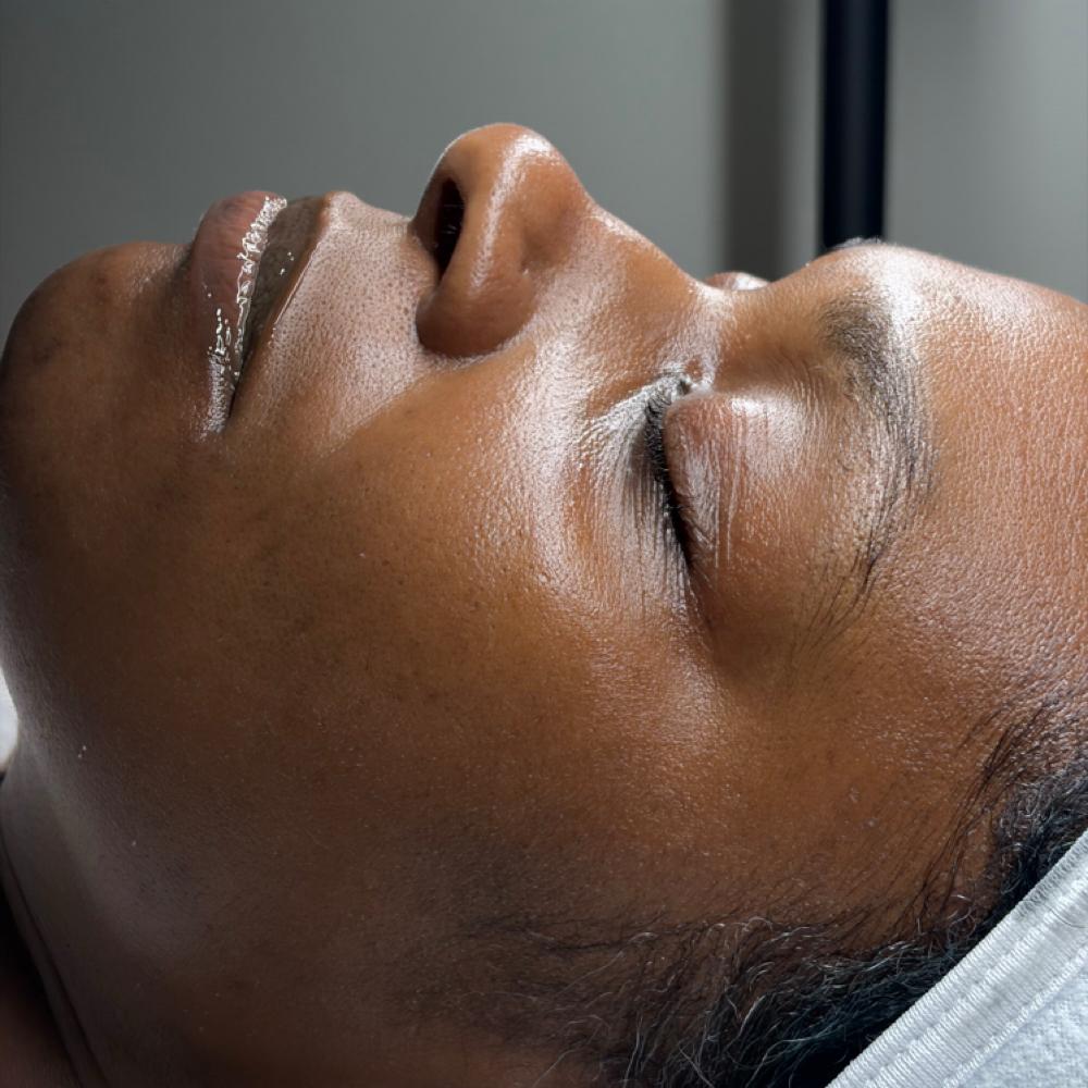 Radiant Facial at Ethereal Esthetics in Huntsville, AL