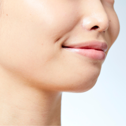 Kybella - 2 Vials at DM Laser Skin Care Solutions in Needham, MA