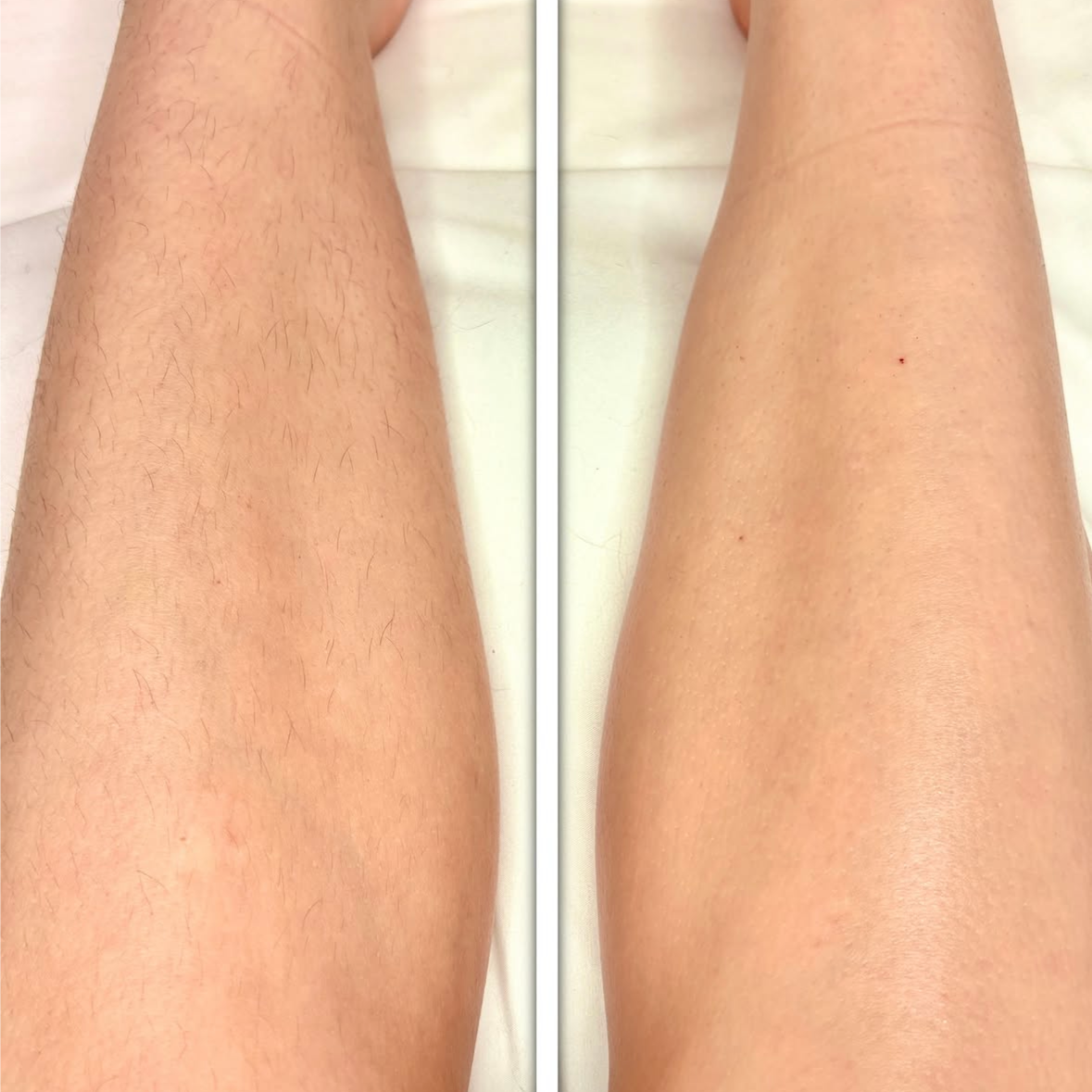 Leg Wax at Moss & Moon in Pflugerville, TX