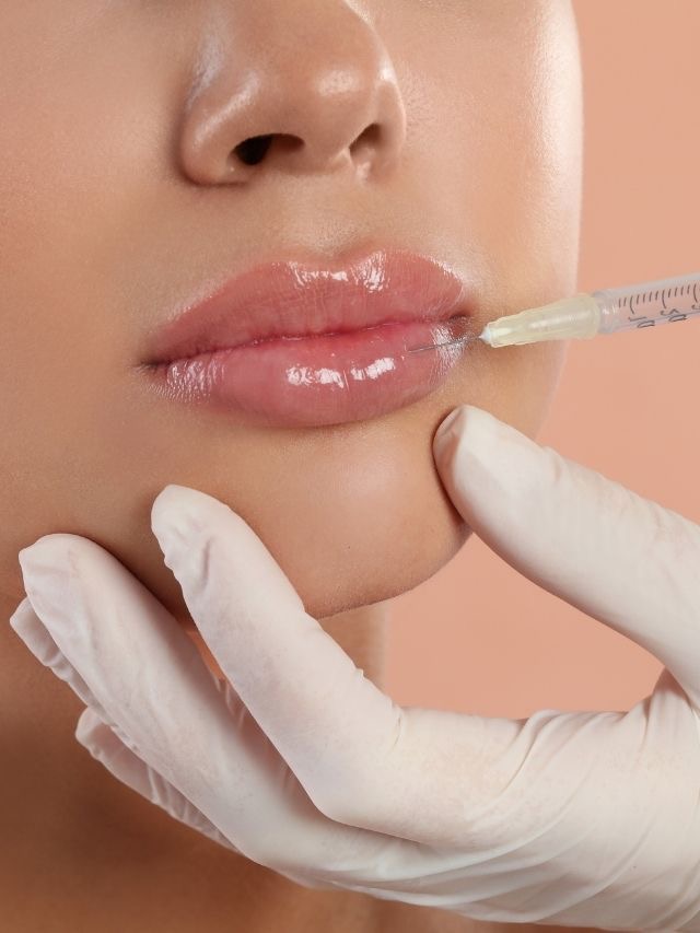 💋 Lip Filler Enhancement