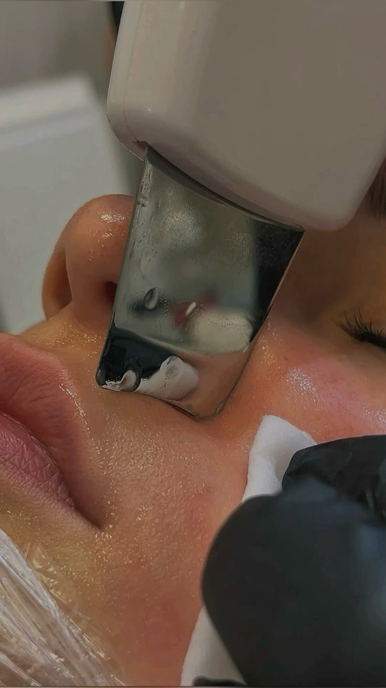 Extractions