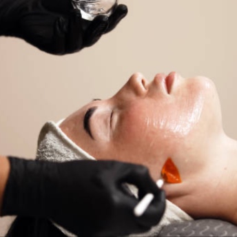 Lazer Peel Resurfacing Program at Enhanced Beauty by Madison Taylor in Spring, TX