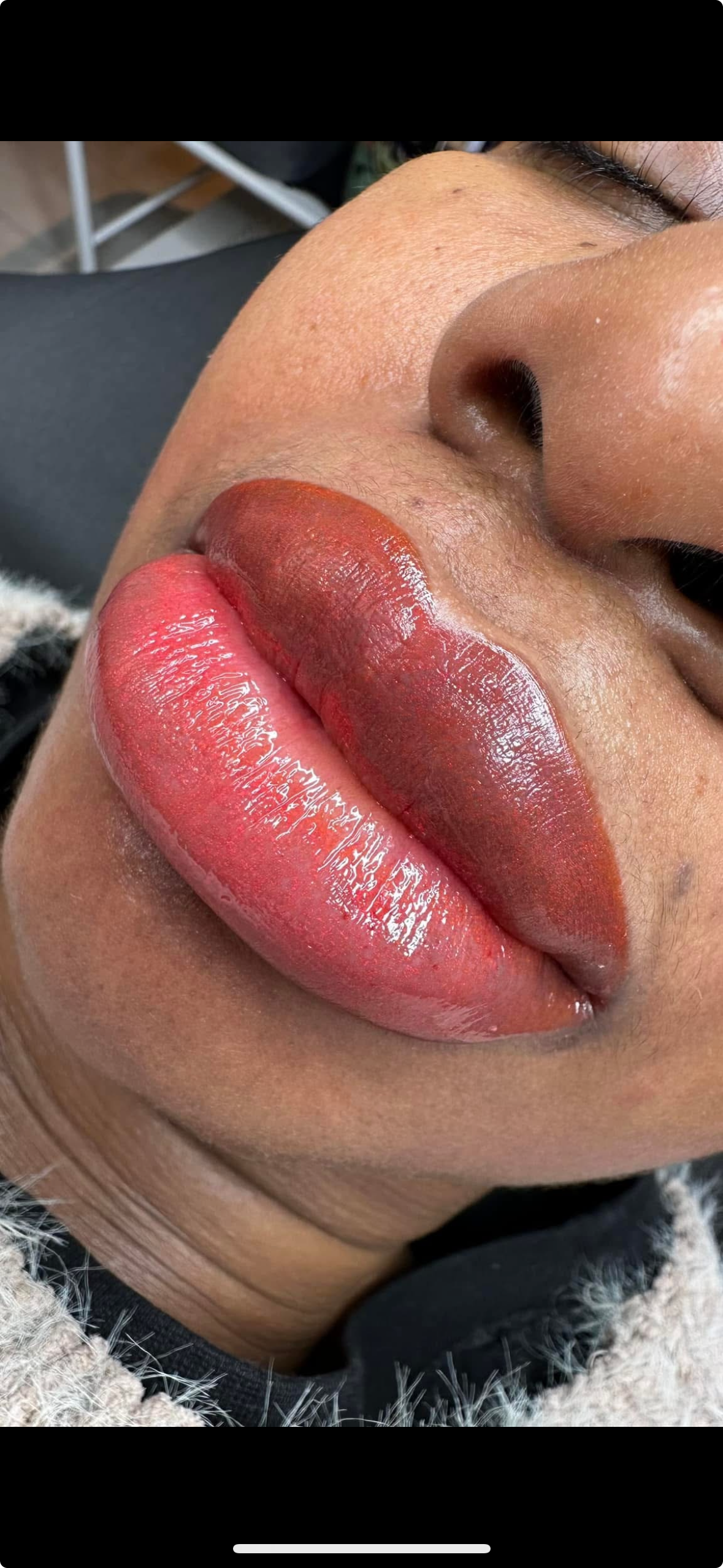 Lip Neutralization