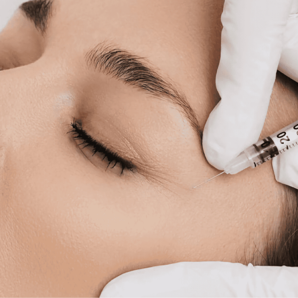 Botox Follow Up at BARE skin by Suzie in El Paso, TX