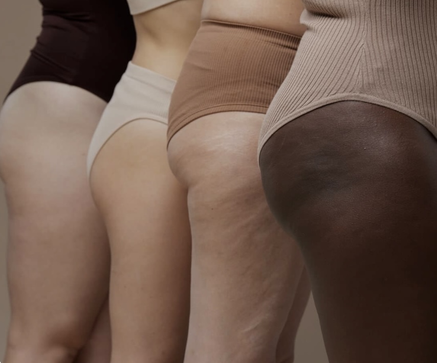 Cellulite Reduction  & Butt Lifting