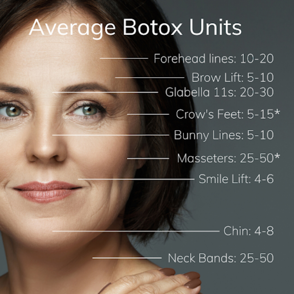 ✨BOTOX PER UNIT (XEOMIN) at RGV PRIME AESTHETICS PLLC in Mcallen, TX
