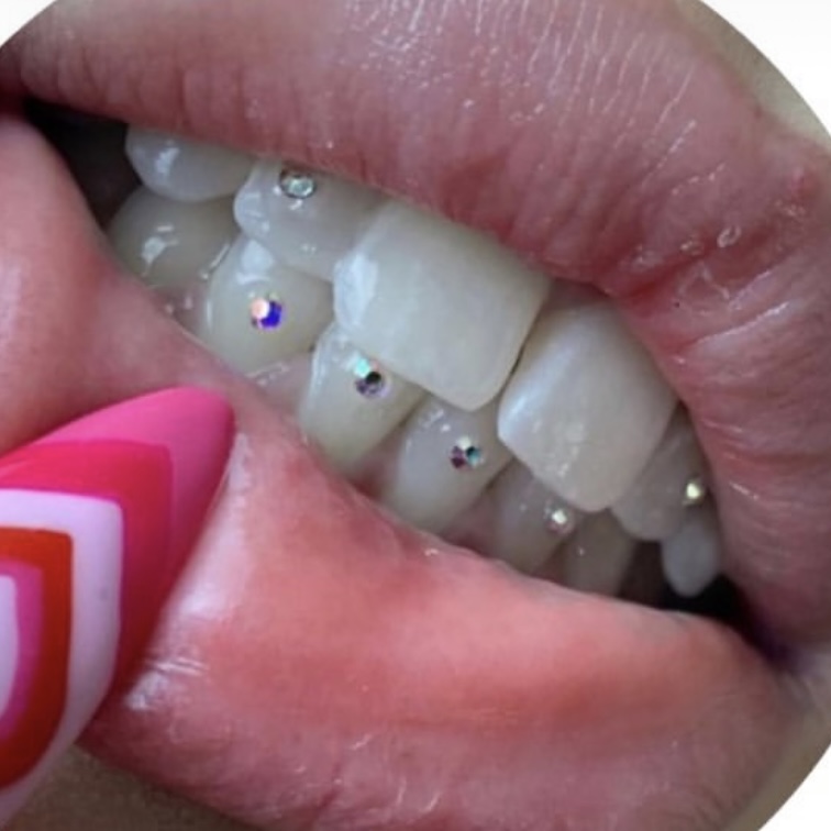 4 Swarovski Tooth Gems