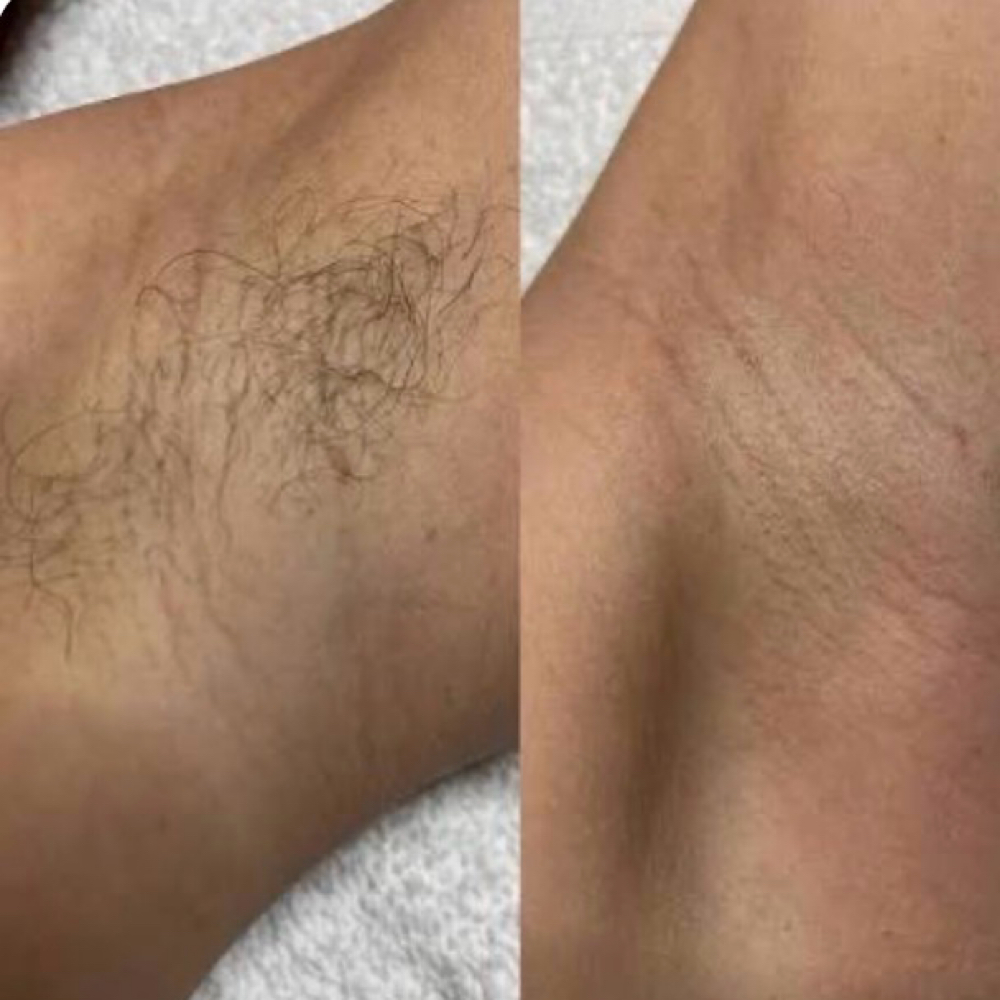 Underarm Wax at Bare Beauty Esthetics LLC in Pasadena, TX