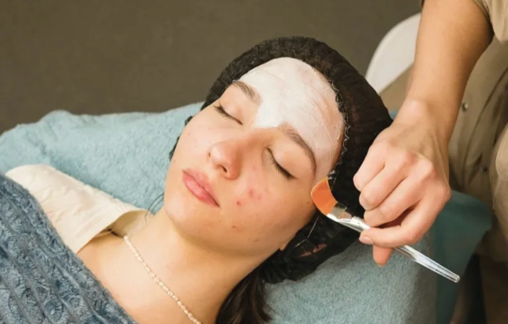 Teen Acne Facial