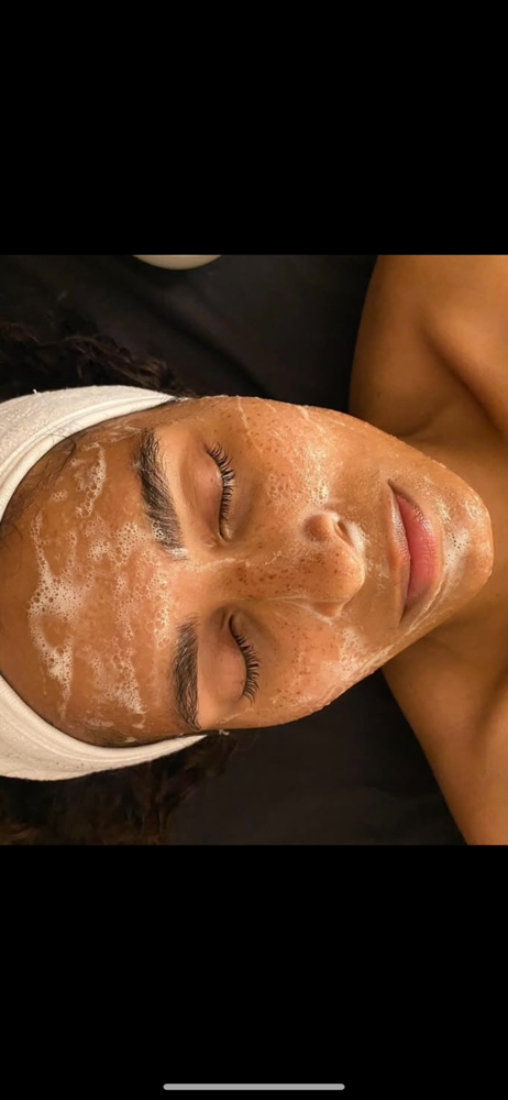 Acne Relief Facial at Brooke Hall Esthetics in Eddyville, KY