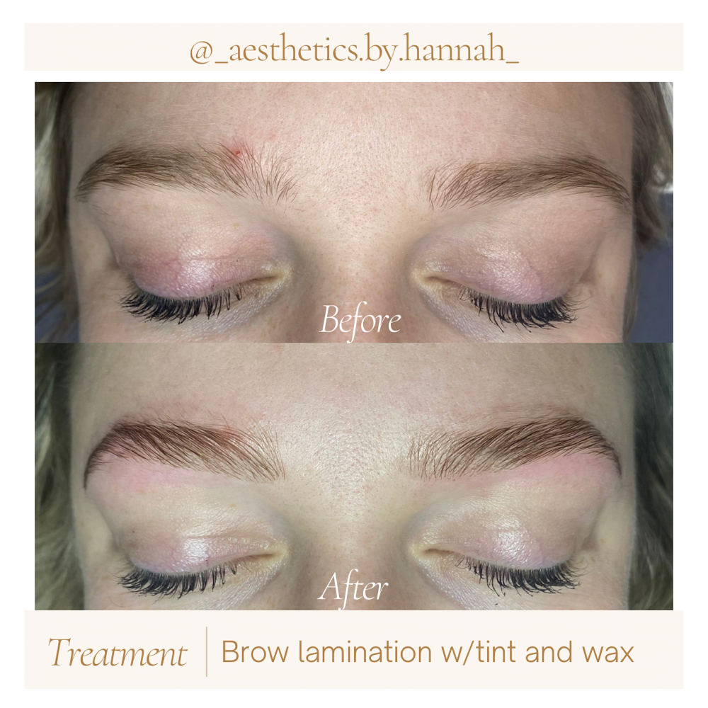 Brow Lamination