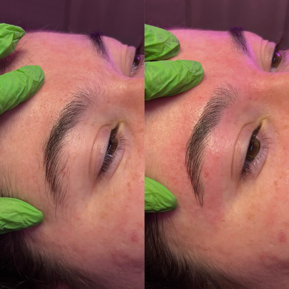 Brow Shaping