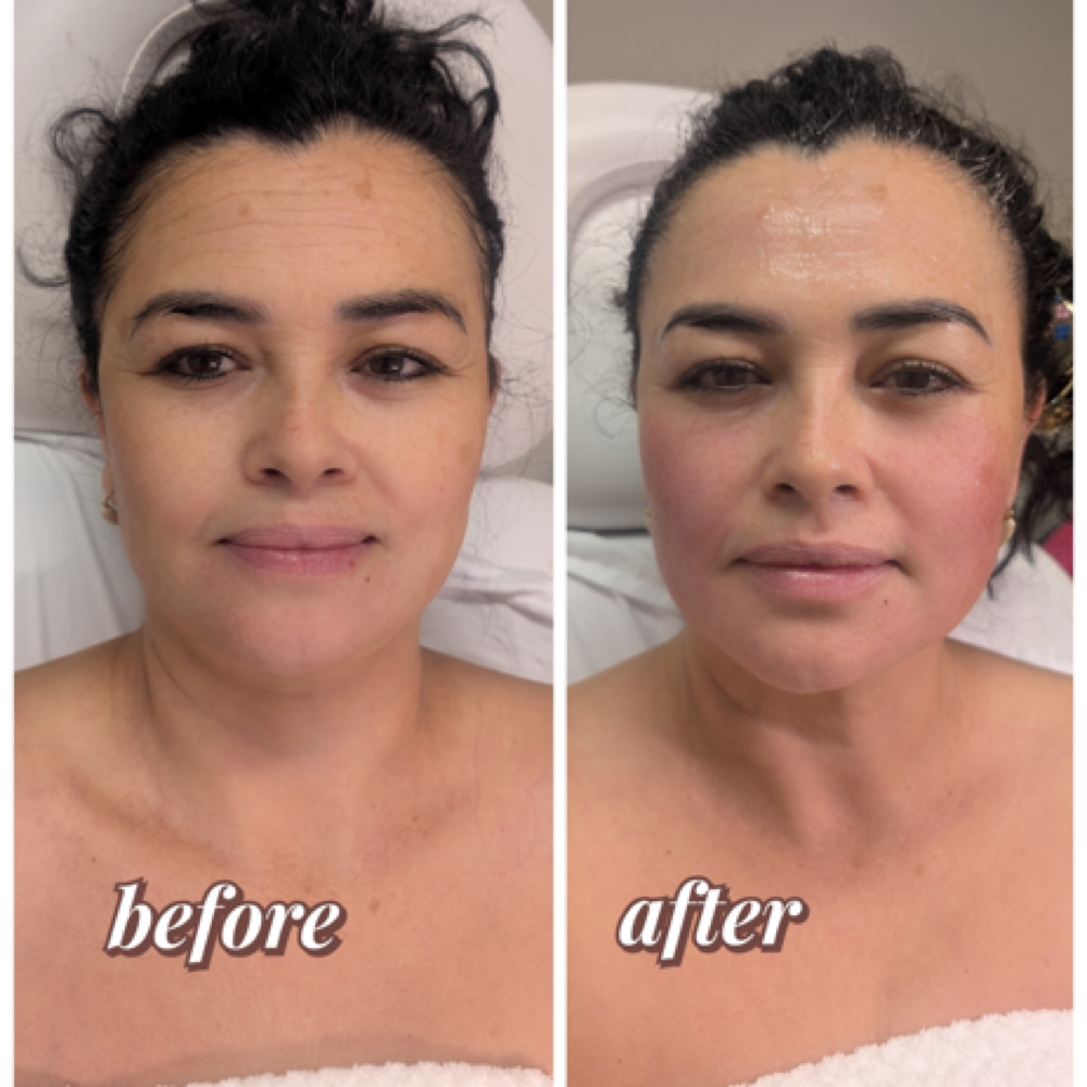 Saturday & Holiday Special at Nenusk Aesthetics in Long Island City, NY