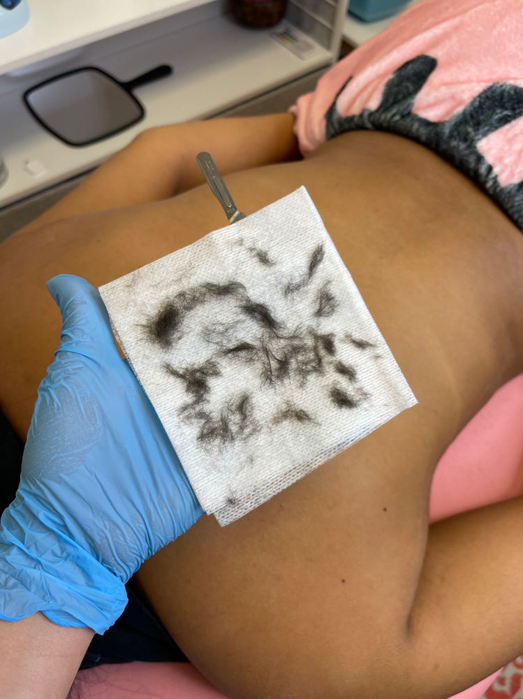 Back Facial