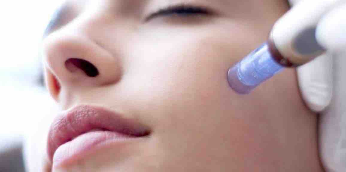 Microneedling Series Of 3