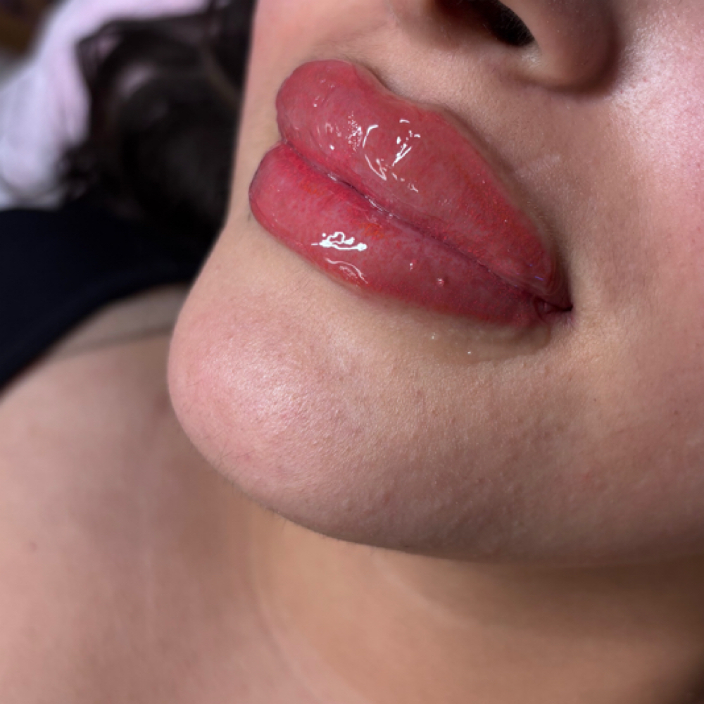 Lip Neutralization at Ikonic Aesthetic Lounge in Asheboro, NC