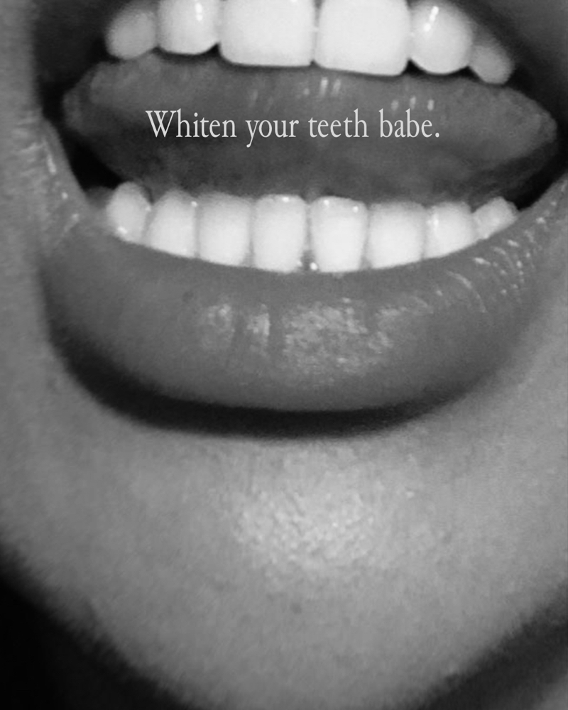Teeth Whitening