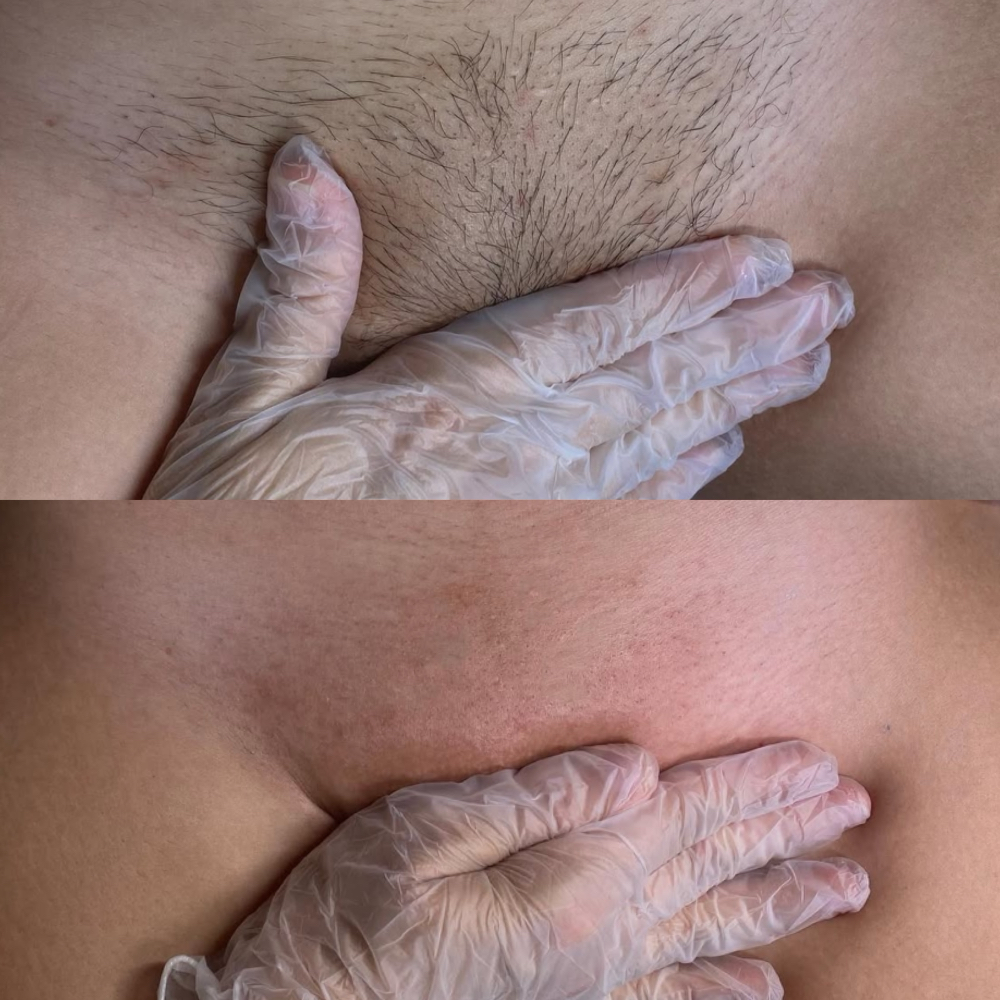 Introductory Brazilian Wax at Mission Valley/ Eastlake (Sun & Mon) in San diego, CA