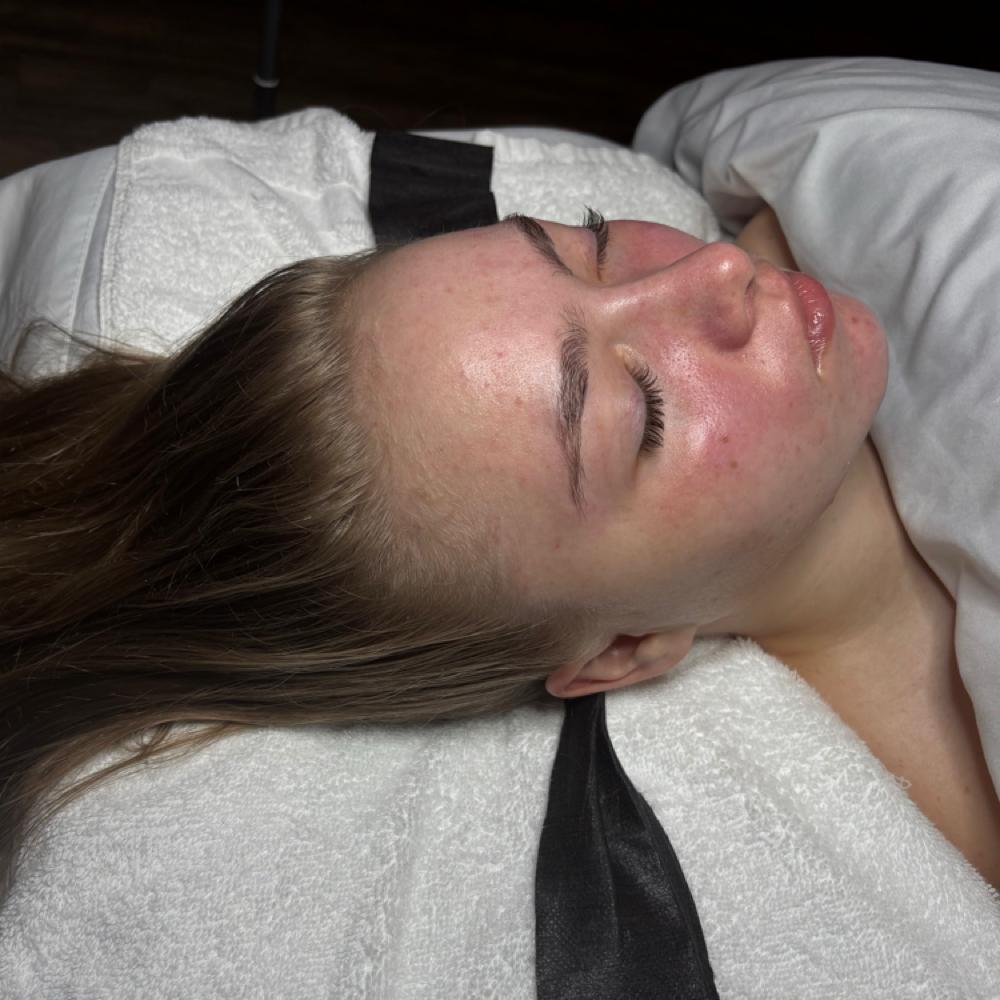 🌿 Acne Support Facial at ShannaLeigh Aesthetics LLC. in Boise, ID