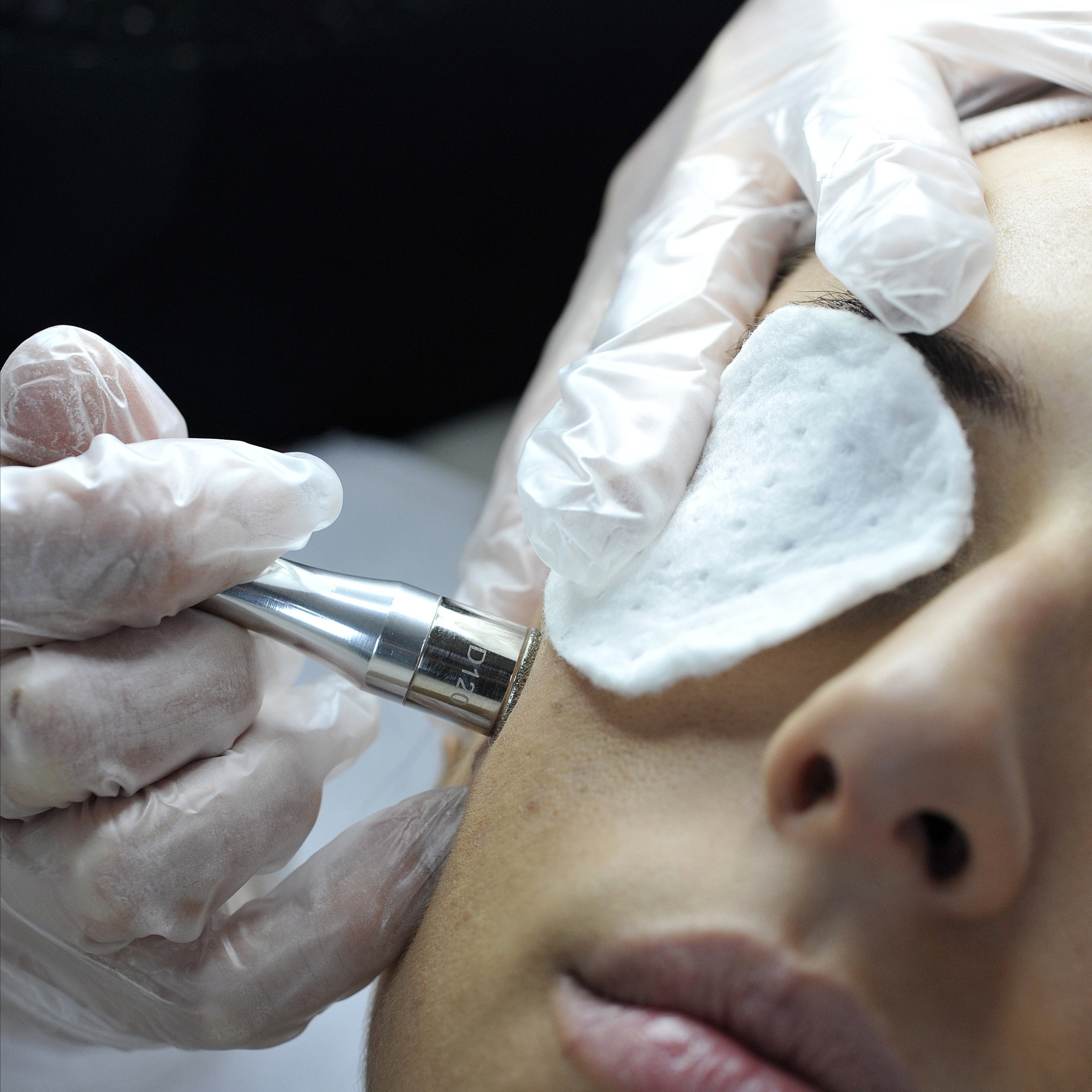 Microdermabrasion at The Skin Sanctuary in Murfreesboro, TN