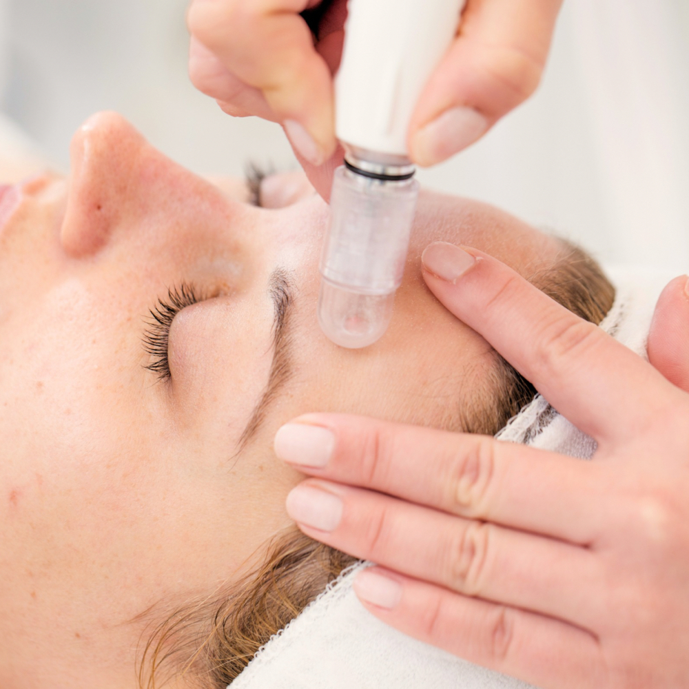 Microdermabrasion at Skin Care by Kayla in Martinez, GA