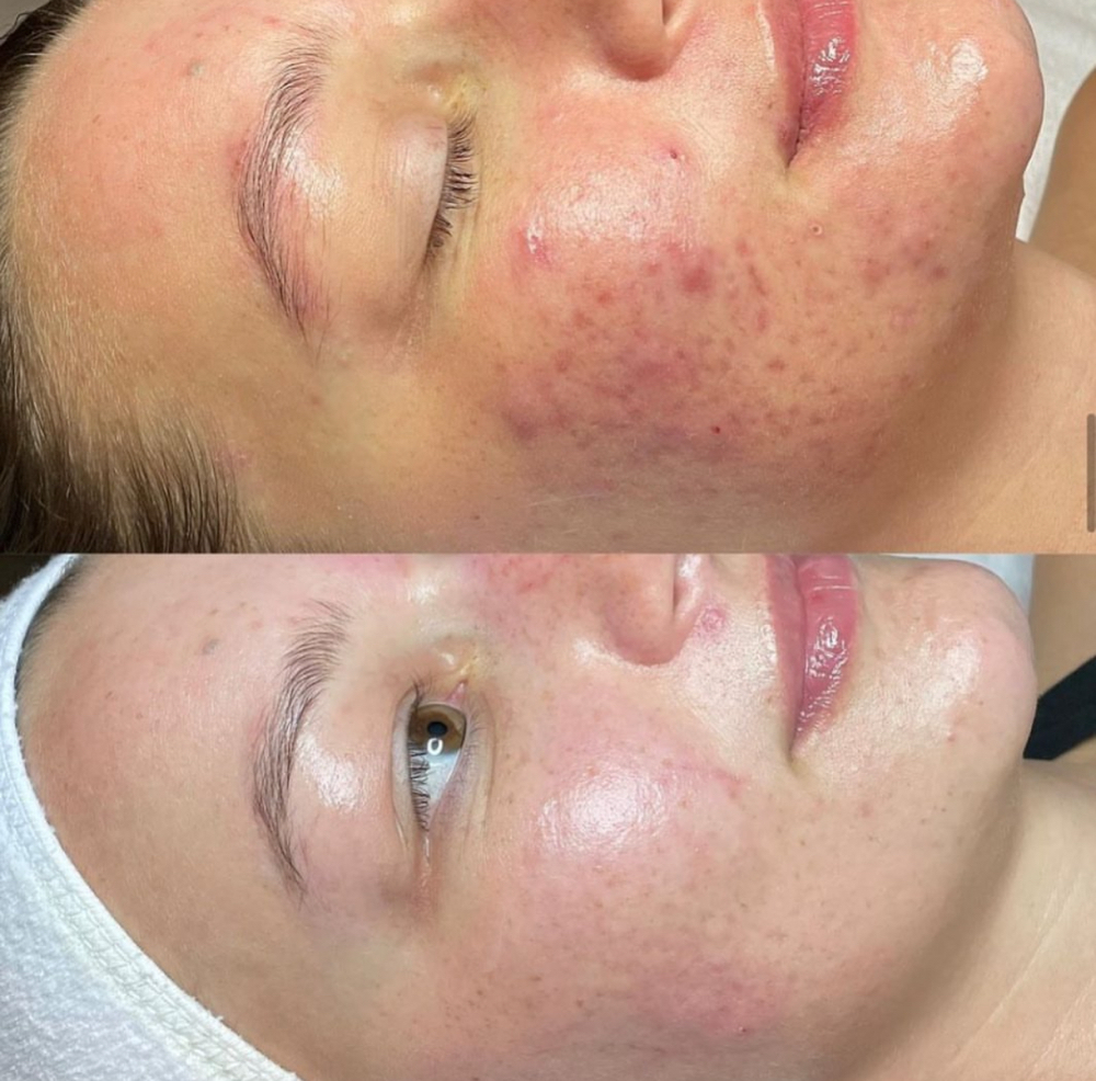 Country Collagen Kickstart