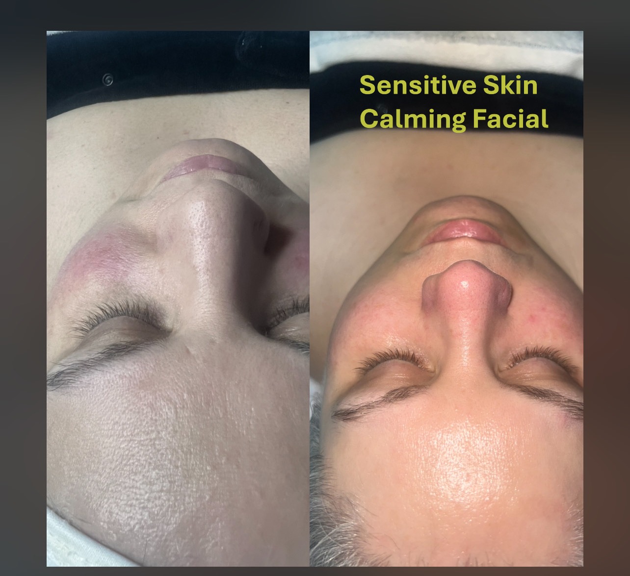 New Client Special: Infusion Facial