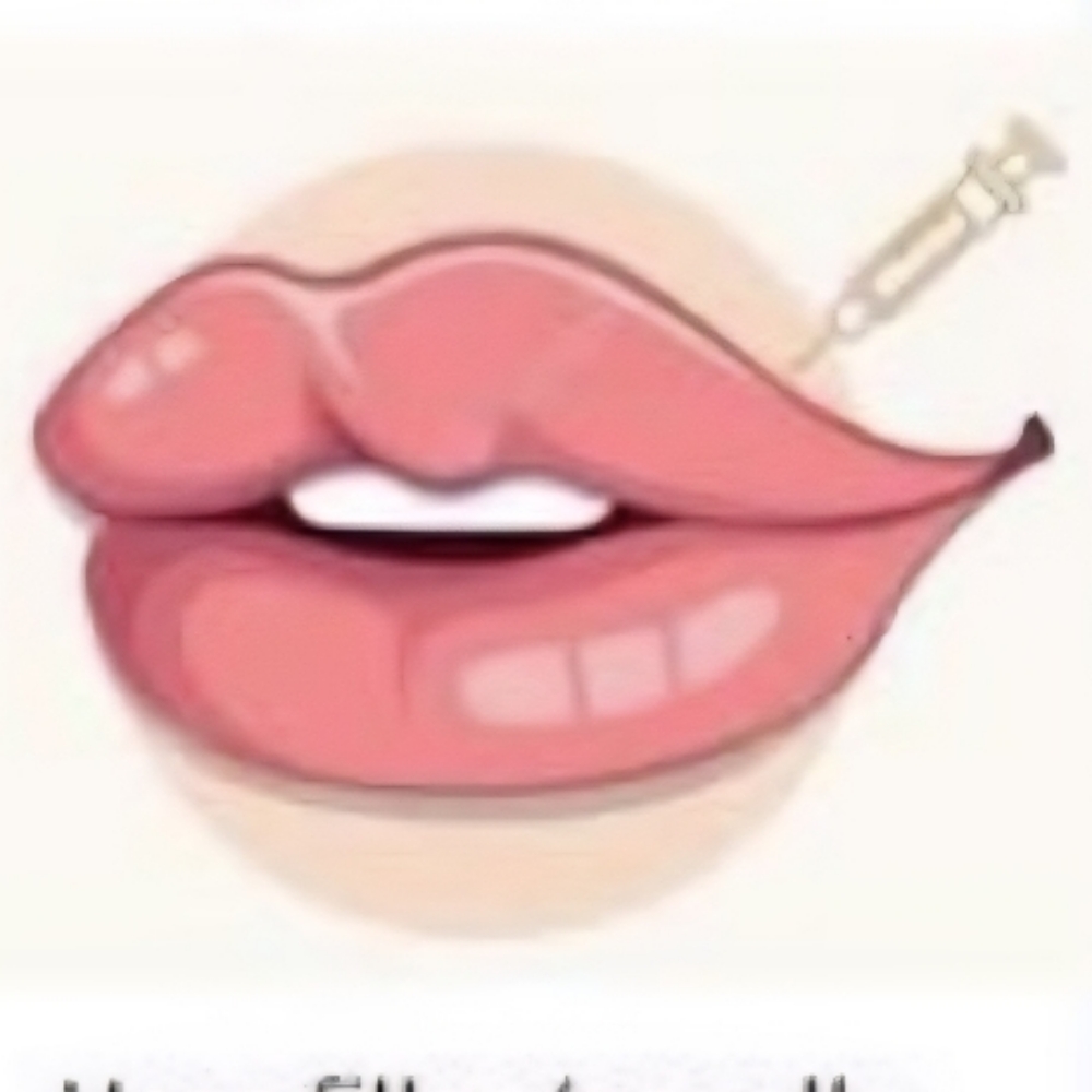 Lip Filler at AmRose Aesthetics in Murfreesboro, TN