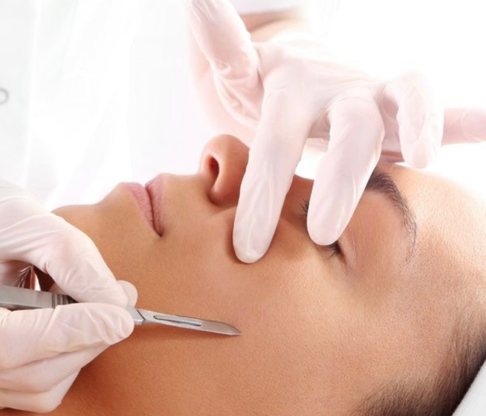 Dermaplaning
