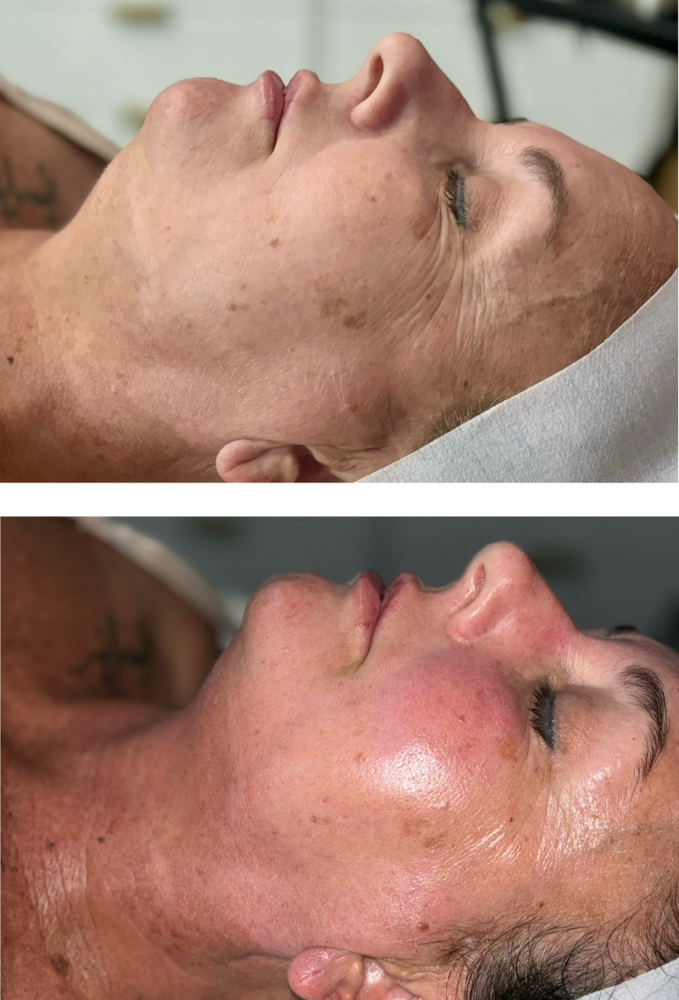 The Luxe Lift Facial
