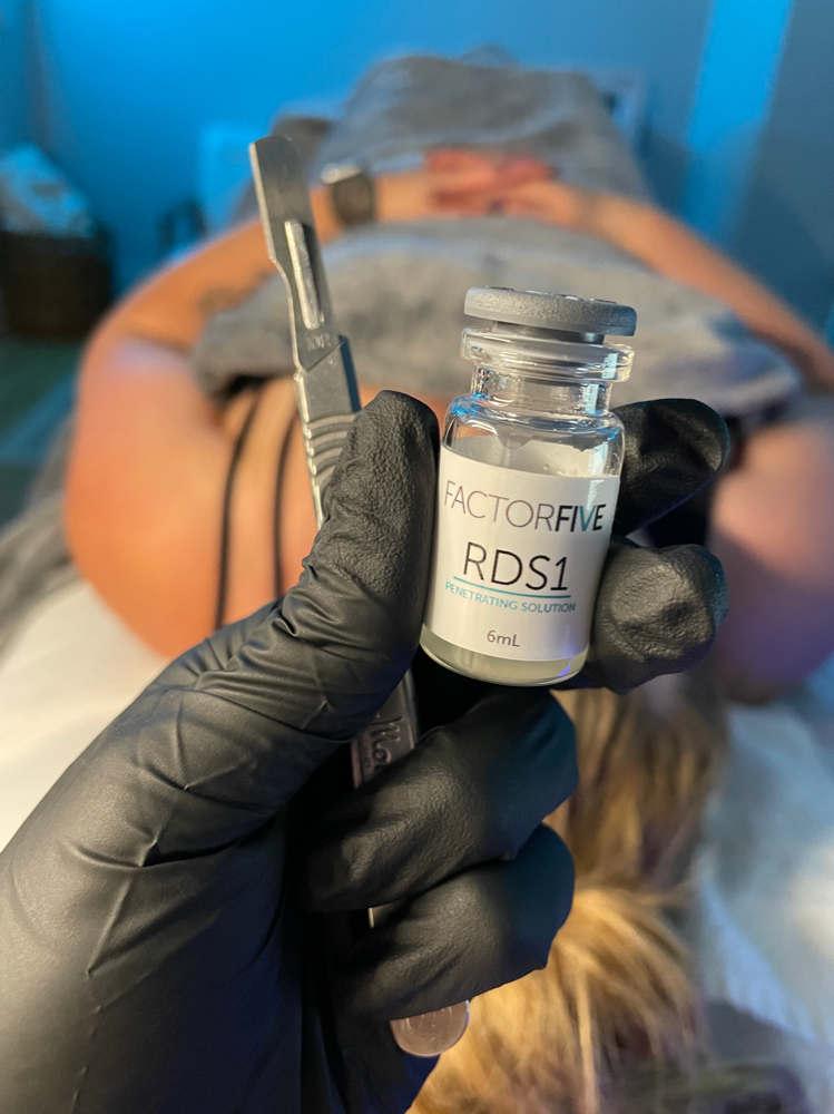 RDS Peel + Dermaplane (Face)