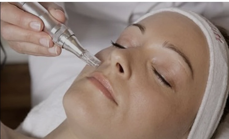 Nano Needling