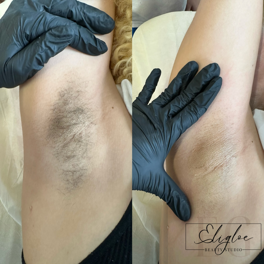 UNDERARM WAX