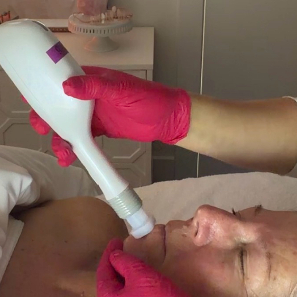 Jet Cold FB Series Of 4 at FB Skin & Wellness in Fernandina Beach, FL