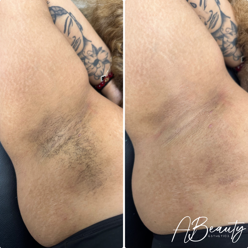 Underarm Wax