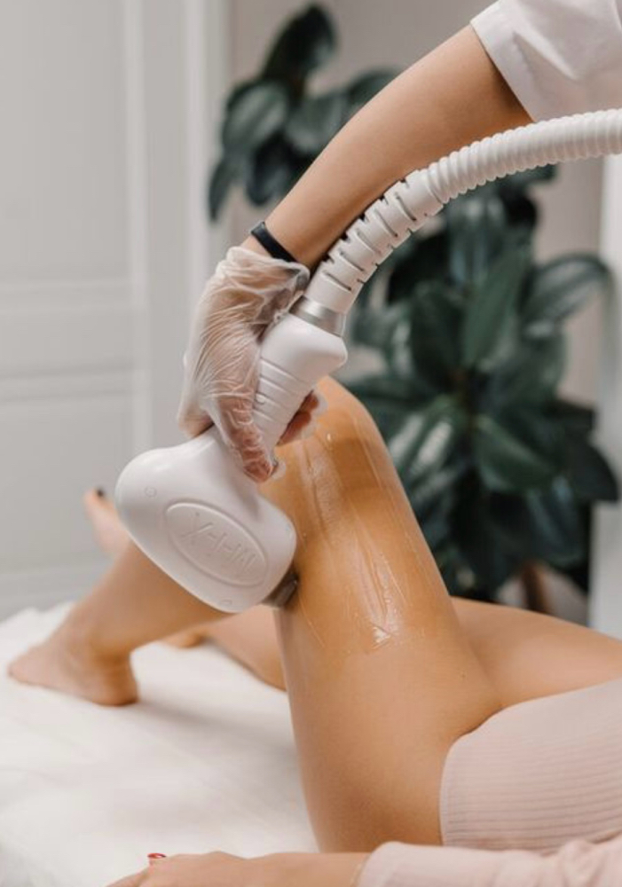 Laser Hair Removal