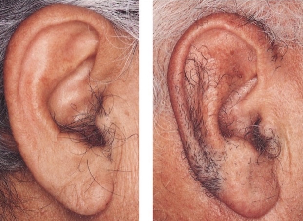Ear + Nose Wax