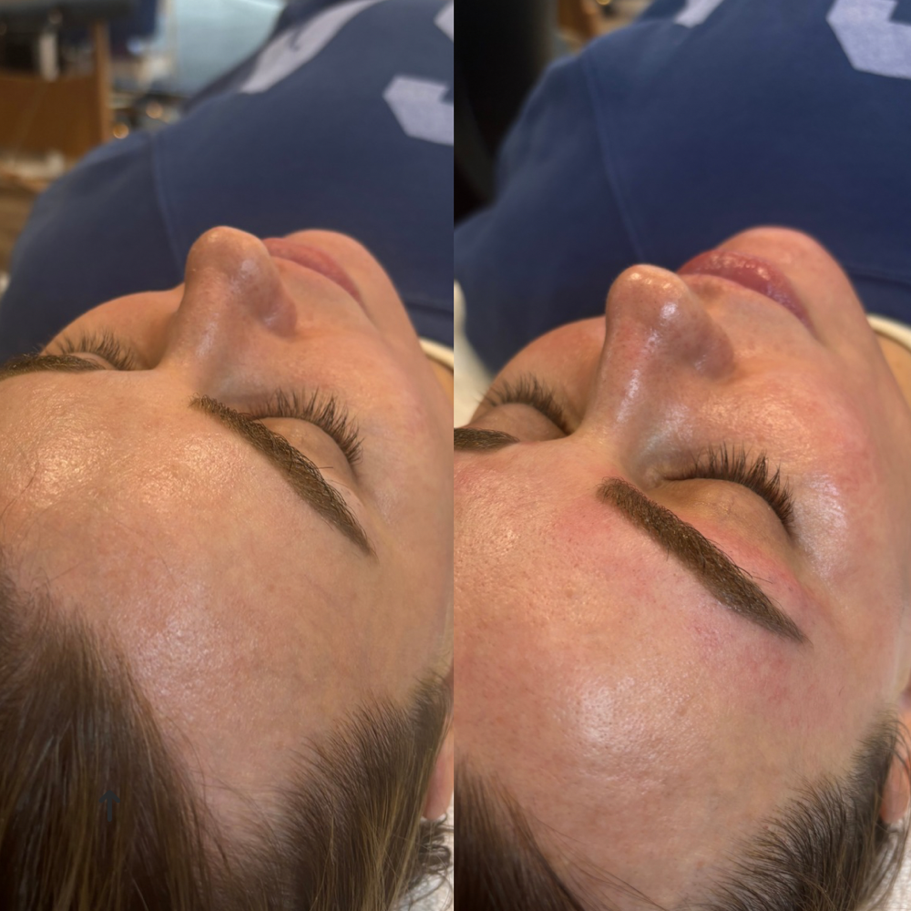 The Essential Refresh Facial