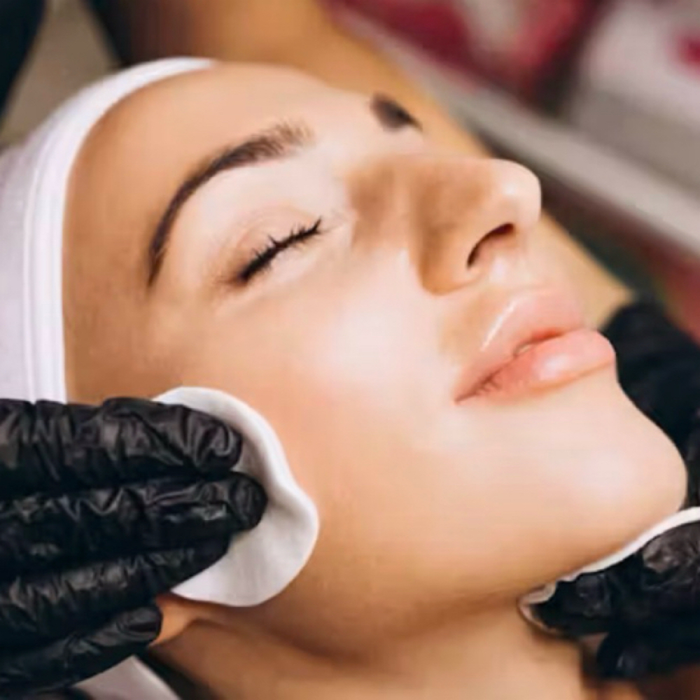 Chemical peel at The Glow Studio by Lydia in Camas, WA