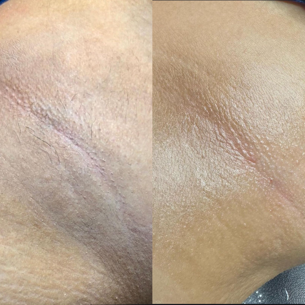 Underarm Wax