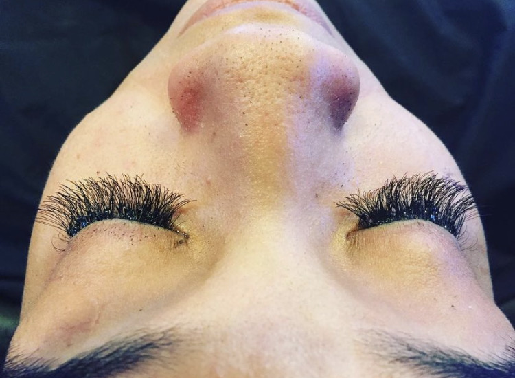 Eyebrow Arch