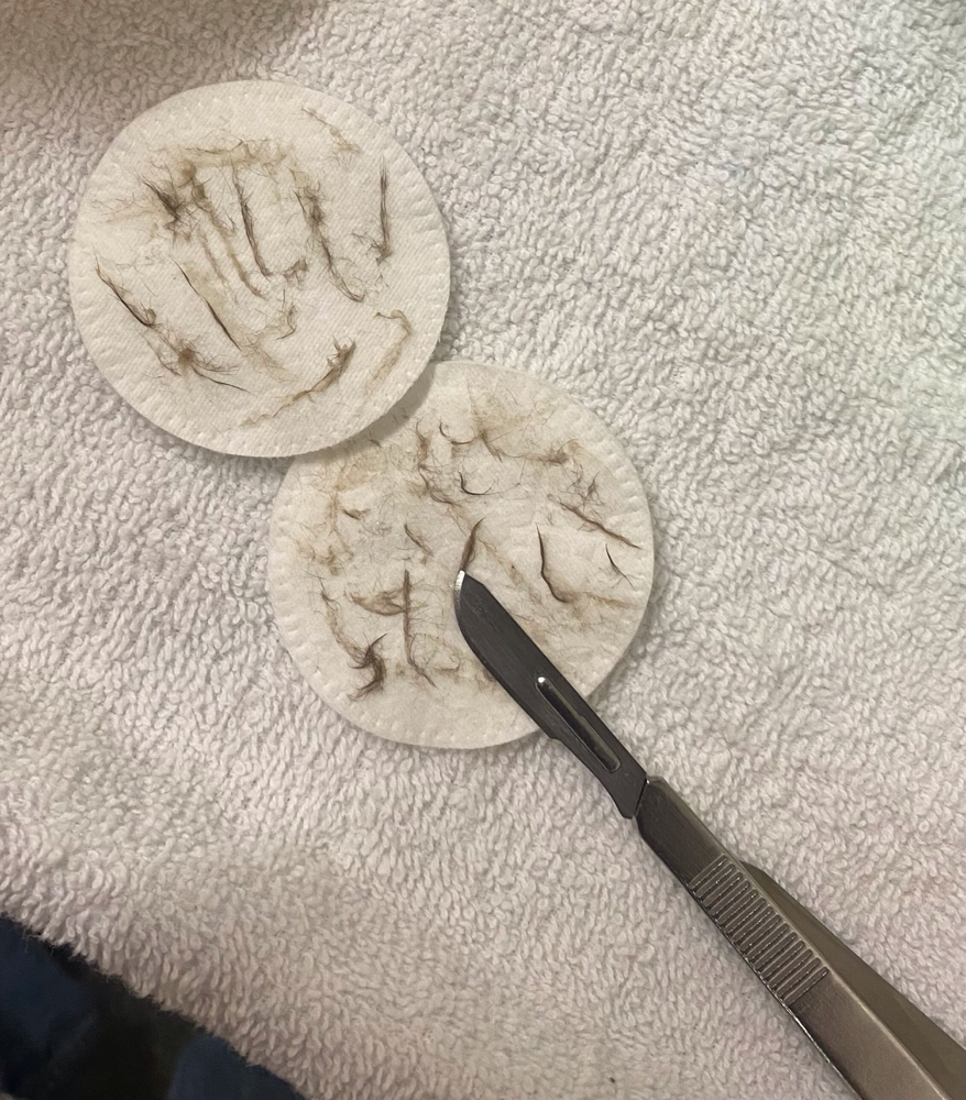 Dermaplaning Add-On