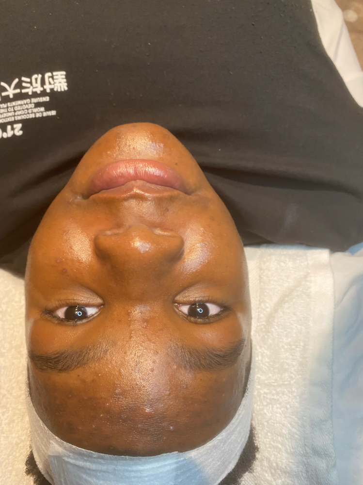Teen Facial at WYN SKIN & BROWS in Dallas, TX